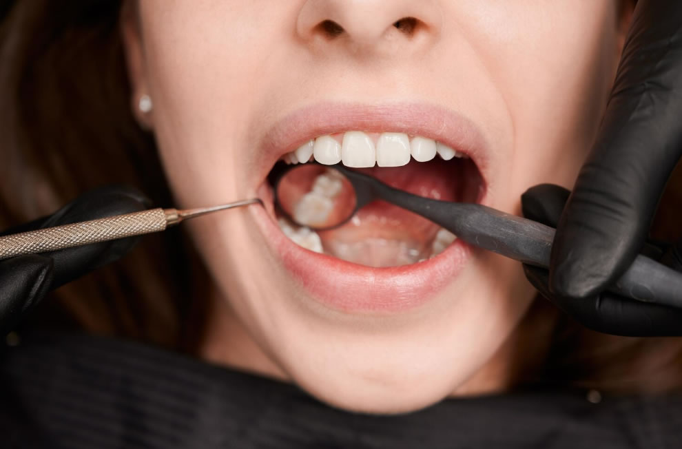 Restauração Dentária em Blumenau: Recupere a Saúde e a Estética do Seu Sorriso