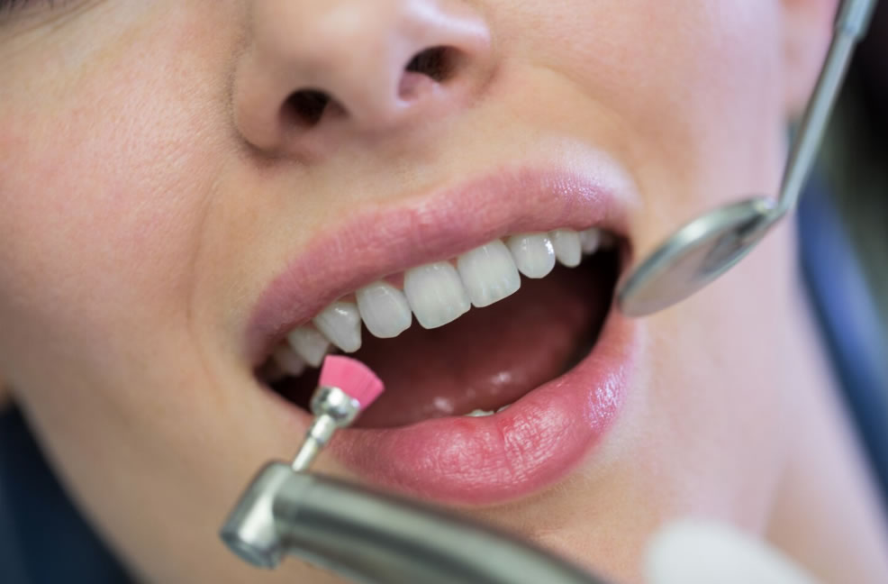 Profilaxia Dental: por que a limpeza profissional é essencial para a saúde do seu sorriso?